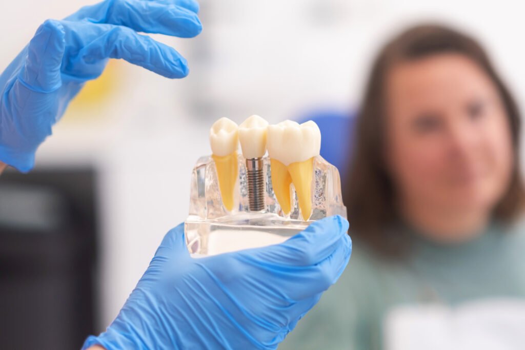 Implante dental