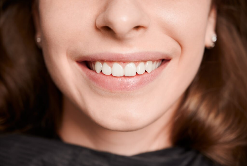 Limpieza dental gratis