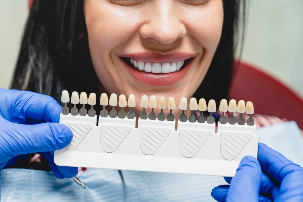 estética dental