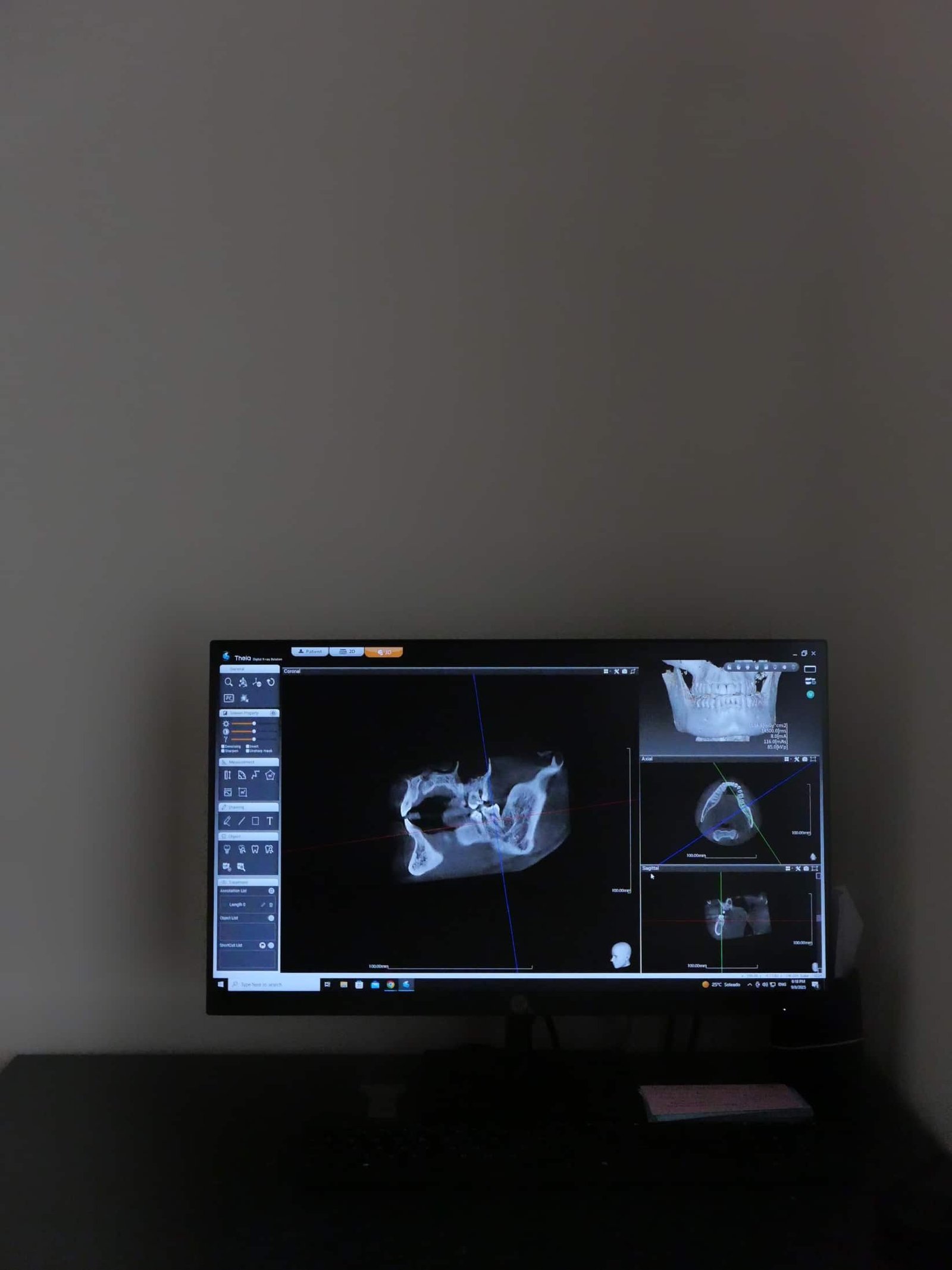 escaner dental 3D