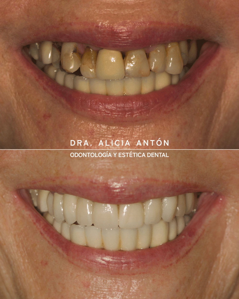 Dentist Gran Alacant