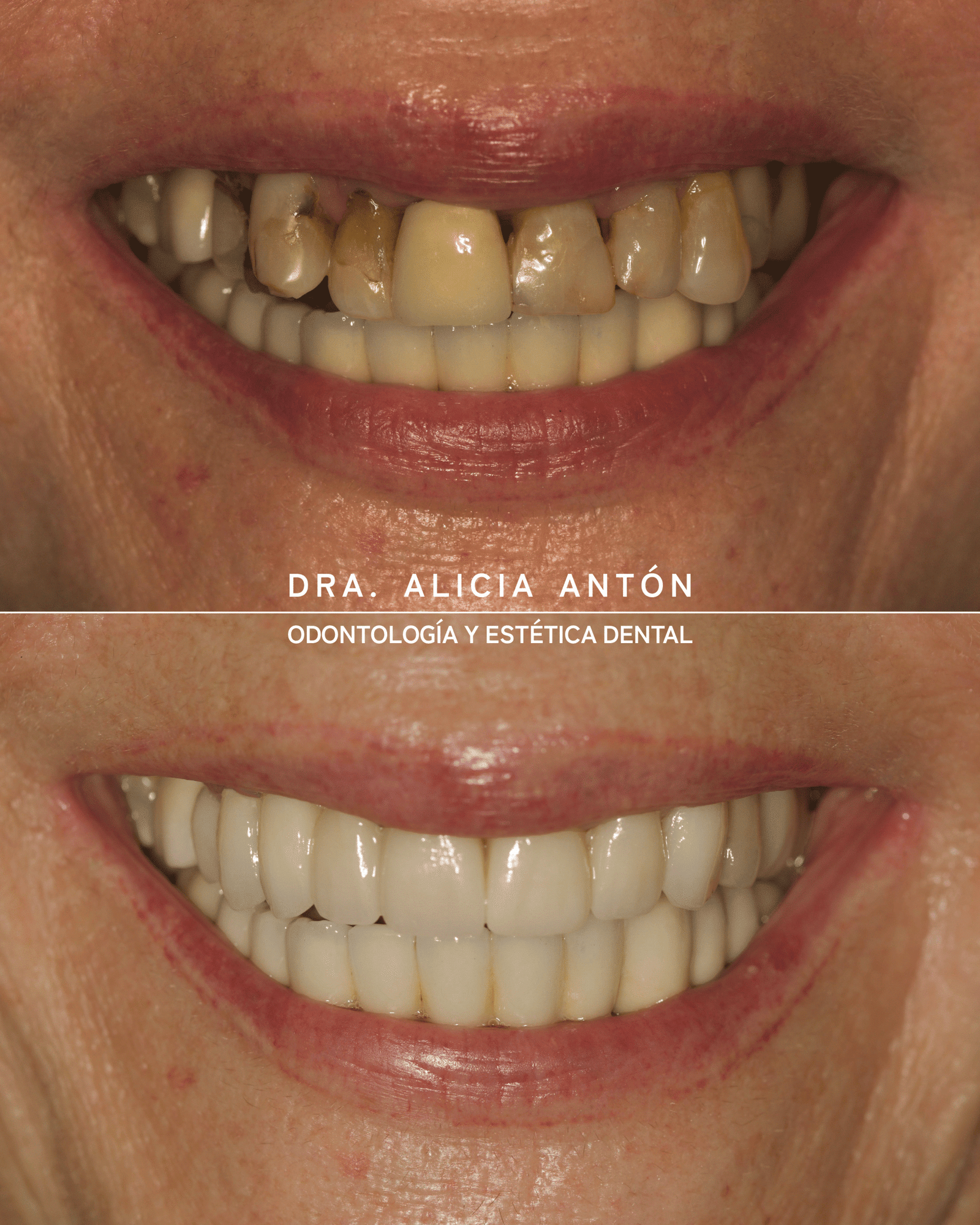 Dentist Gran Alacant