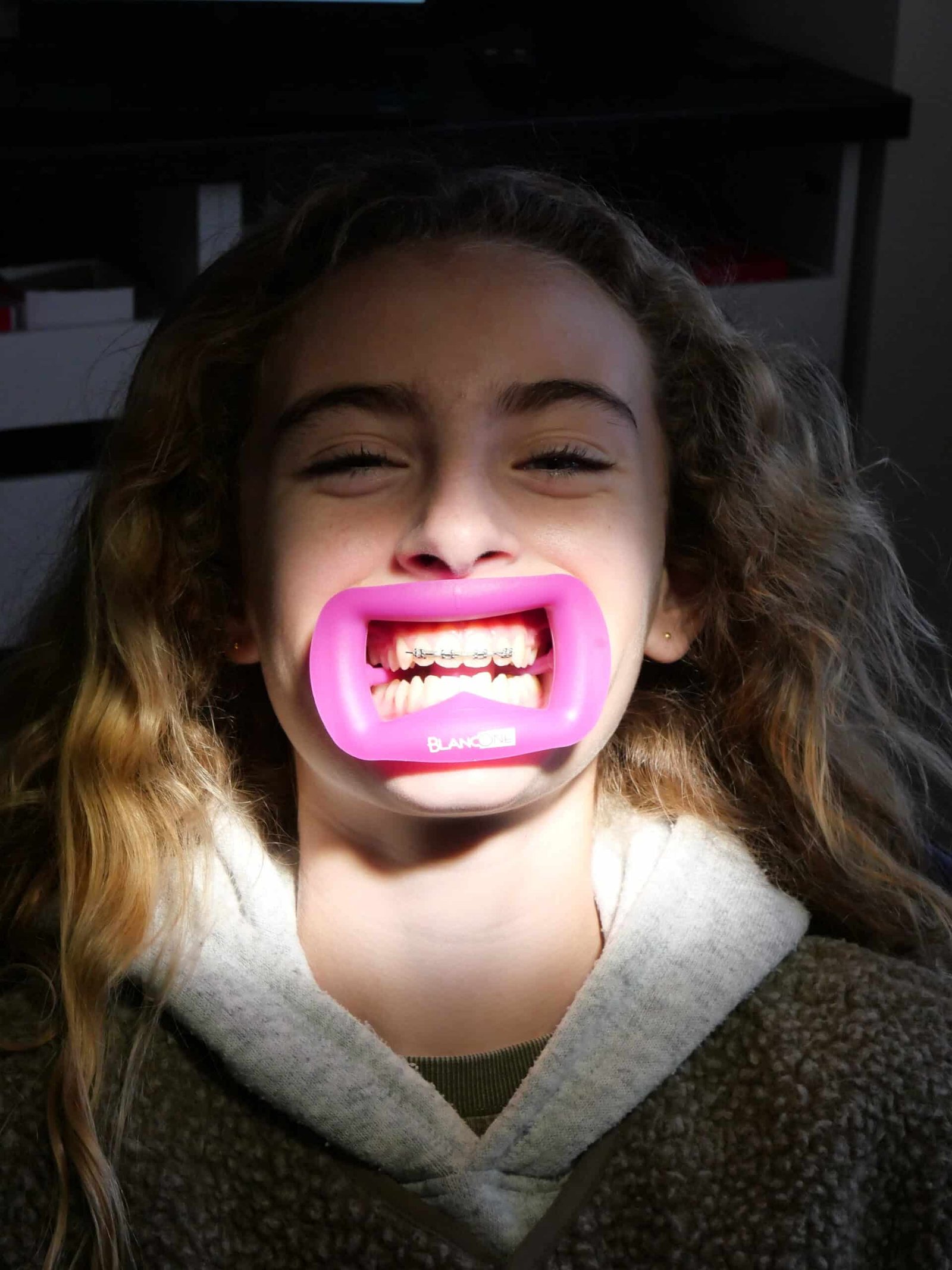 Dentista niños Santa Pola. salud dental