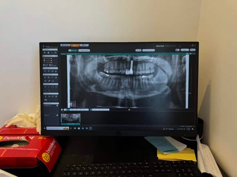 Prótesis dental